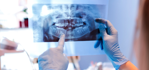 doctores de ECCO revisando radiografía