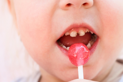 niño con caries en los dientes tomándose un chupachups