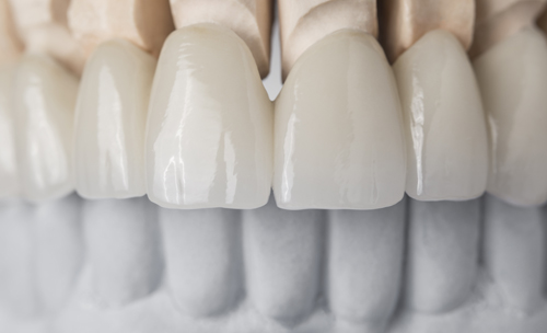 imagen de detalle de los dientes de una prótesis